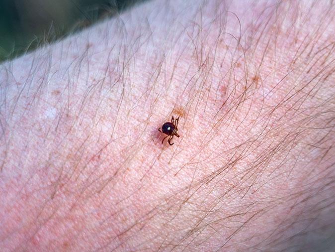 Lone Star Tick Bites To Blame For Meat Allergy