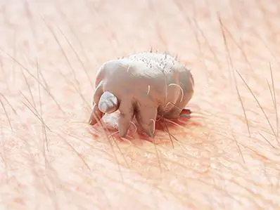 scabie-mite-3d-rendering